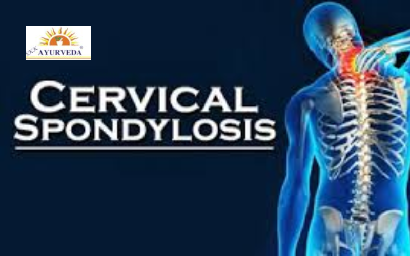 Cervical Spondylosis Treatment in Delhi